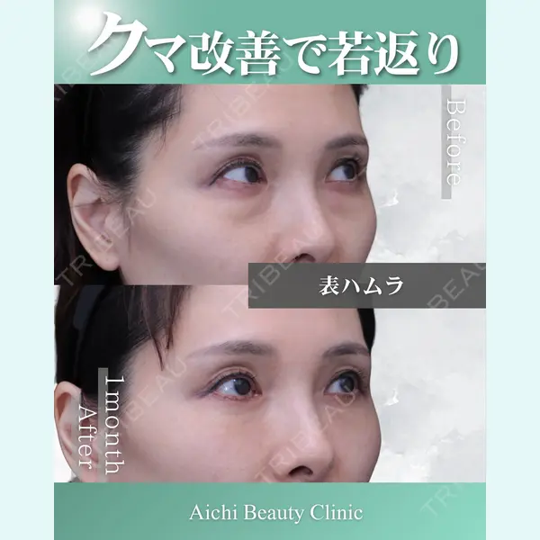 あいちビューティークリニック栄本院 横山 侑祐医師の症例