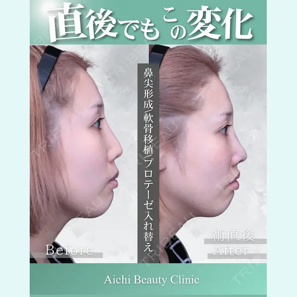 あいちビューティークリニック栄本院 横山 侑祐医師の症例