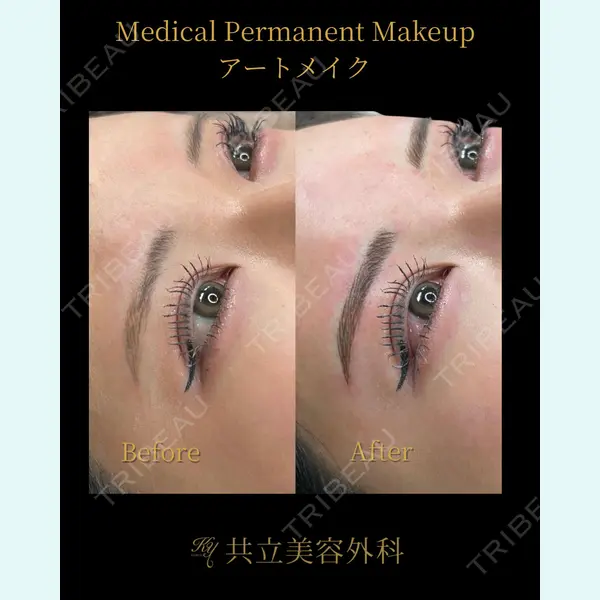 共立美容外科 新宿本院の症例