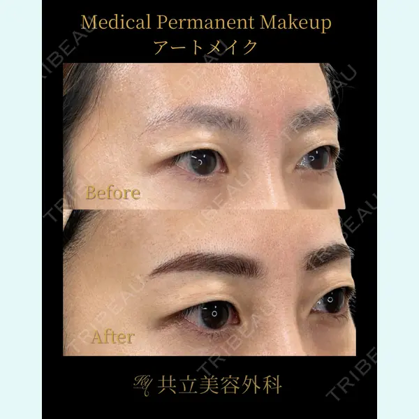 共立美容外科 新宿本院の症例