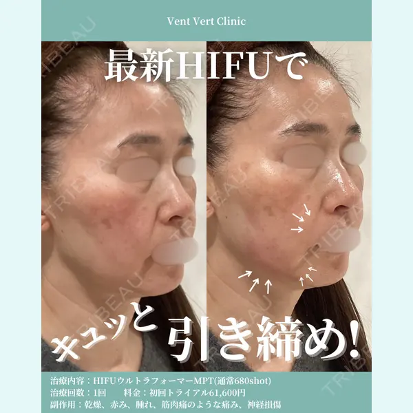 ヴァンヴェールクリニック 高槻院 李 愚姫医師の症例