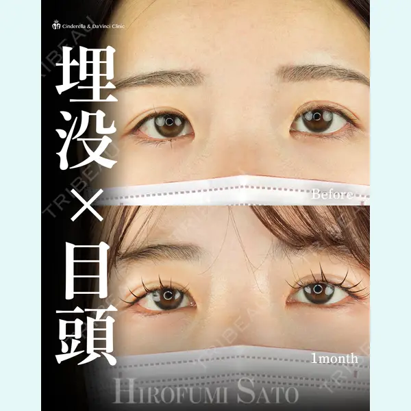 シンデレラ＆ダヴィンチクリニック 佐藤 博文医師の症例