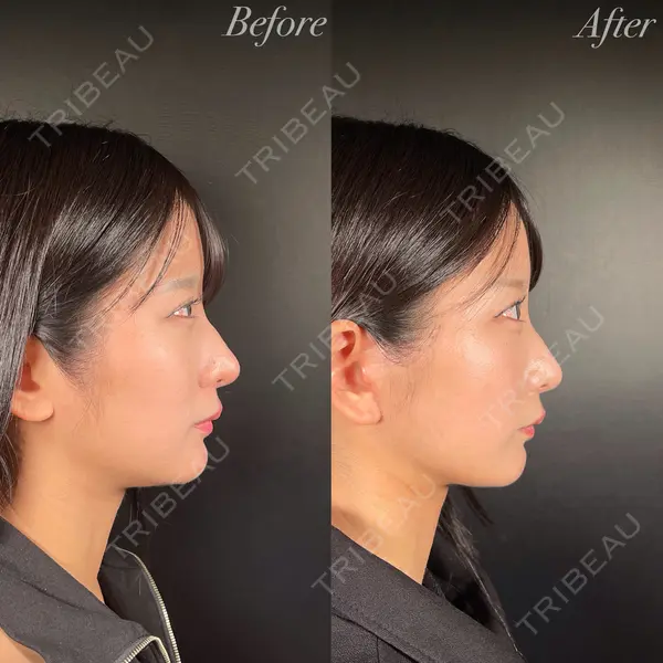 R Beauty CLINIC 銀座院 吉田　慧医師の症例