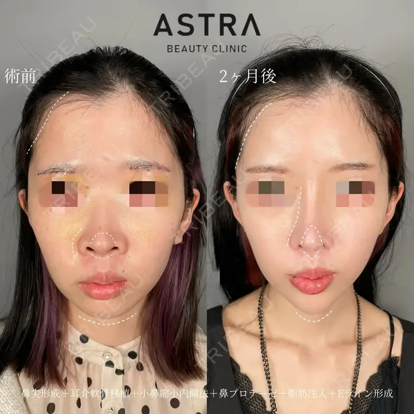ASTRA BEAUTY CLINIC 塩満 惠子医師の症例