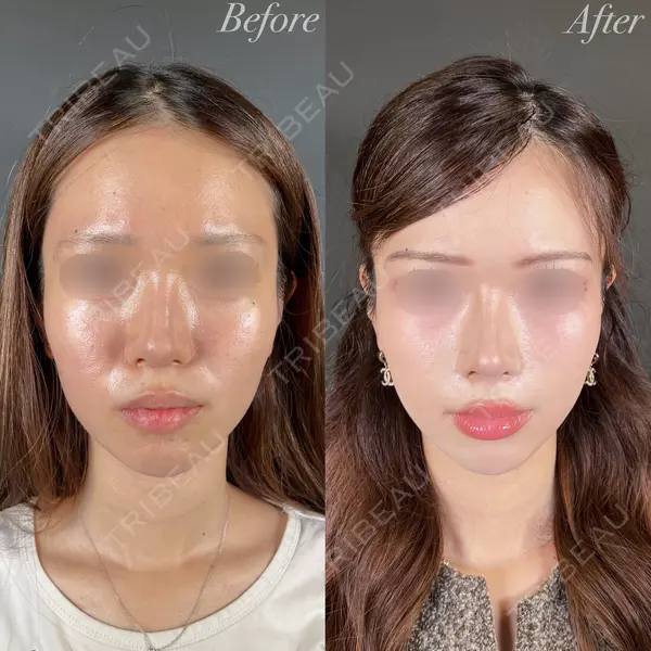 R Beauty CLINIC 大阪院 小池 泰弘医師の症例