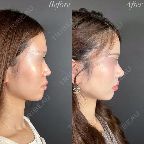 R Beauty CLINIC 大阪院 小池 泰弘医師の症例