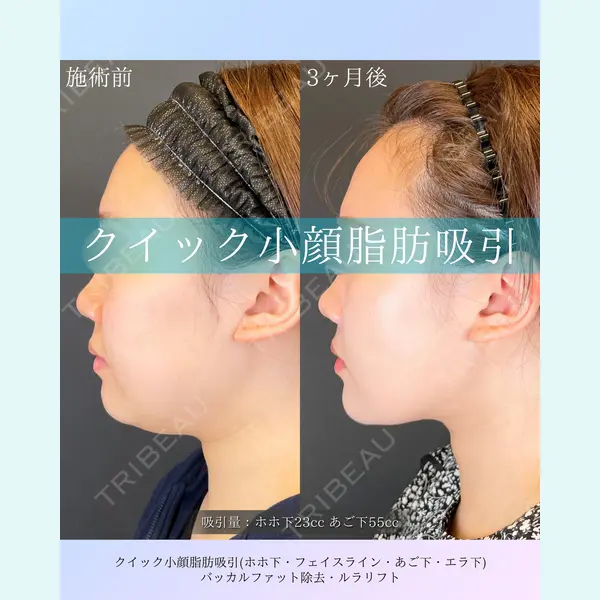 ルラ美容クリニック 札幌本院 佐藤 雄紀医師の症例