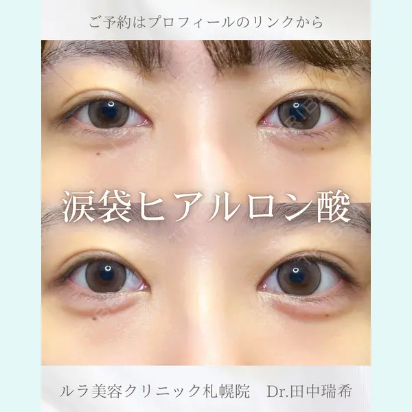 ルラ美容クリニック 札幌本院 田中 瑞希医師の症例