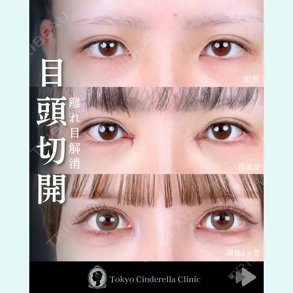 東京シンデレラ美容外科 池袋院 石井 達也医師の症例