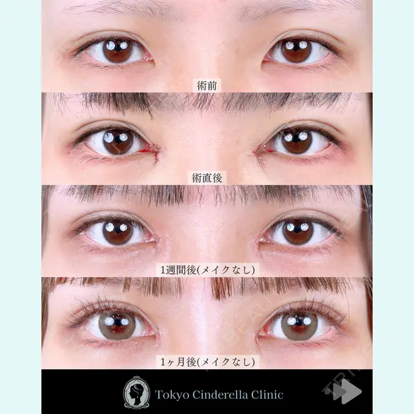 東京シンデレラ美容外科 池袋院 石井 達也医師の症例