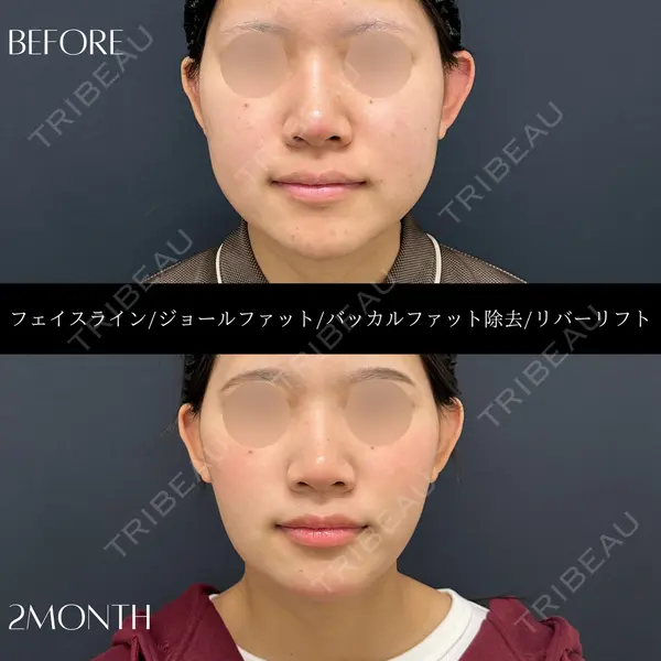 RIVER CLINIC（リバークリニック）の症例