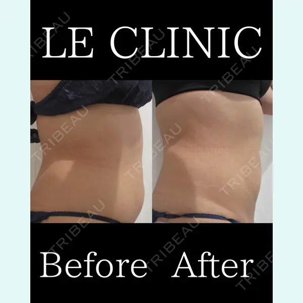 LE CLINIC 喜多　俊博医師の症例