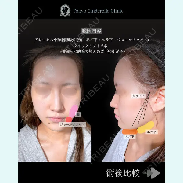 東京シンデレラ美容外科 池袋院 石井 達也医師の症例