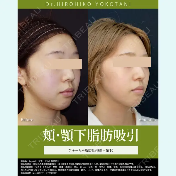 湘南美容クリニック 大阪梅田本院 横谷 仁彦医師の症例