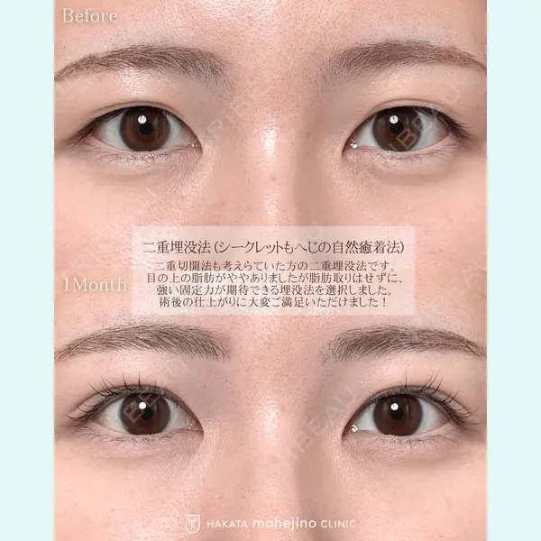 博多もへじのクリニック 村田 将光医師の症例