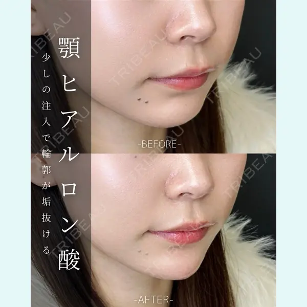 ルラ美容クリニック 大宮院 / ルラスキンクリニック 大宮院 右京 大季医師の症例