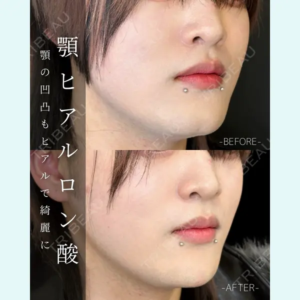 ルラ美容クリニック 大宮院 / ルラスキンクリニック 大宮院 右京 大季医師の症例