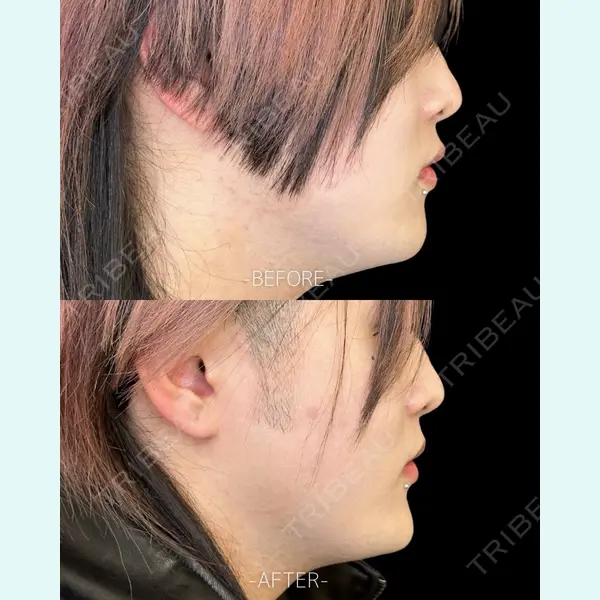 ルラ美容クリニック 大宮院 / ルラスキンクリニック 大宮院 右京 大季医師の症例