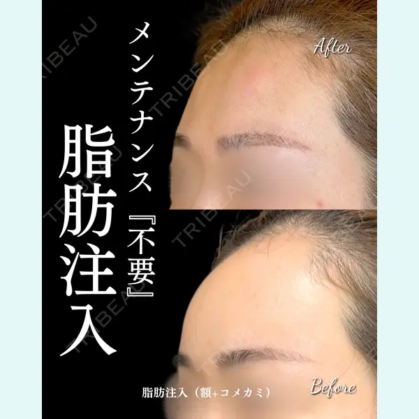 ルラ美容クリニック 大宮院 / ルラスキンクリニック 大宮院 右京 大季医師の症例