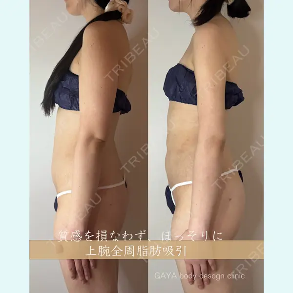 GAYA body design clinic 飯ヶ谷 重来医師の症例