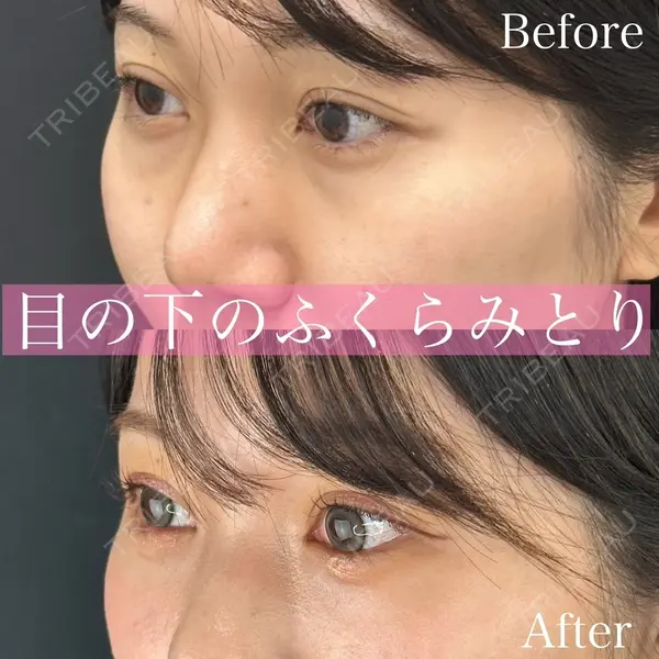 ルラ美容クリニック 渋谷本院 昼間 路子医師の症例