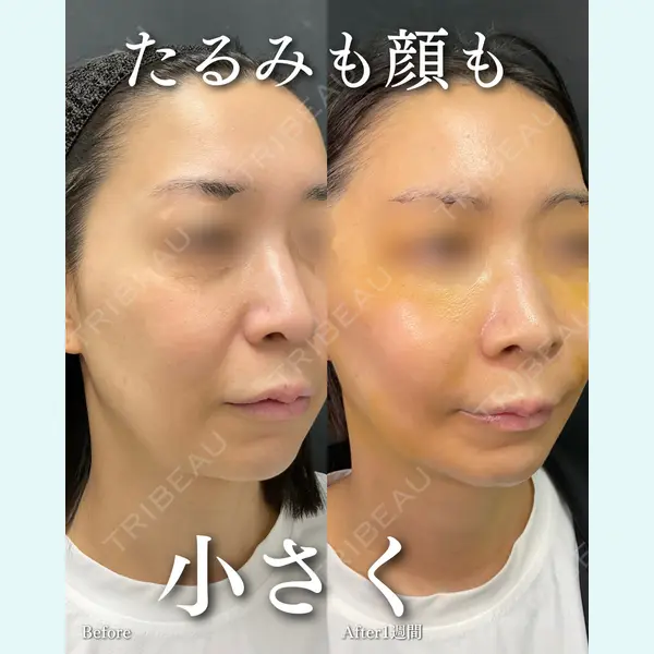 ルラ美容クリニック 渋谷本院 住友 沙織医師の症例