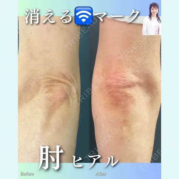 ルラ美容クリニック 渋谷本院 住友 沙織医師の症例