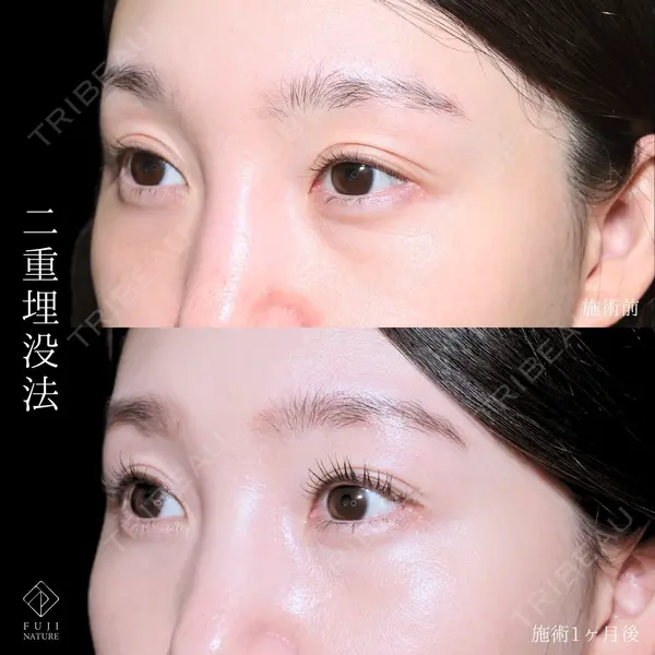 藤・ナチュレ美容クリニック 銀座院 小川 杏平医師の症例