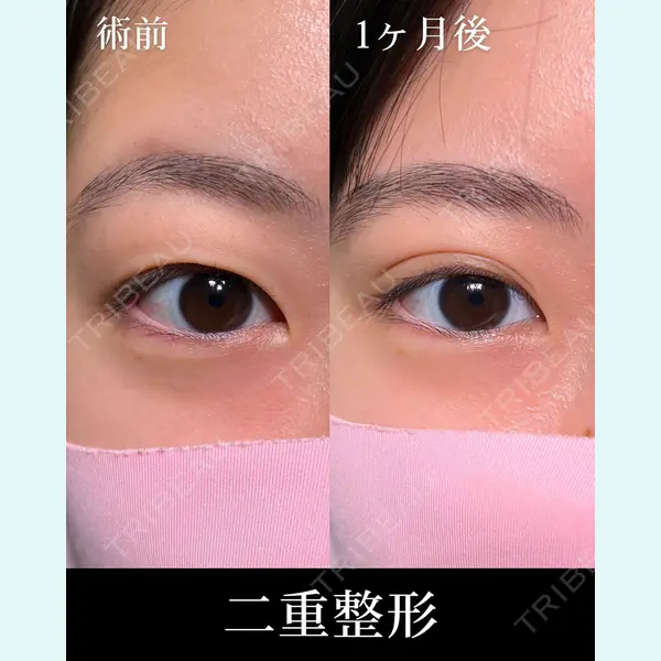 HAAB×DREAM BEAUTY CLINIC 大阪梅田院 柏木 太雅医師の症例