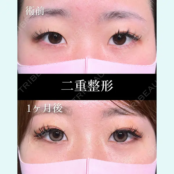 HAAB×DREAM BEAUTY CLINIC 大阪梅田院 柏木 太雅医師の症例