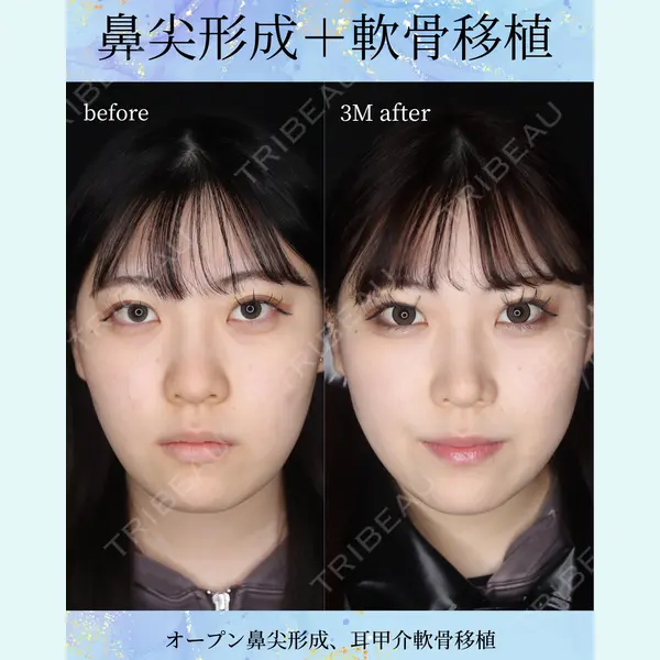 千葉美容外科アイビークリニック 藤田 愛樹医師の症例