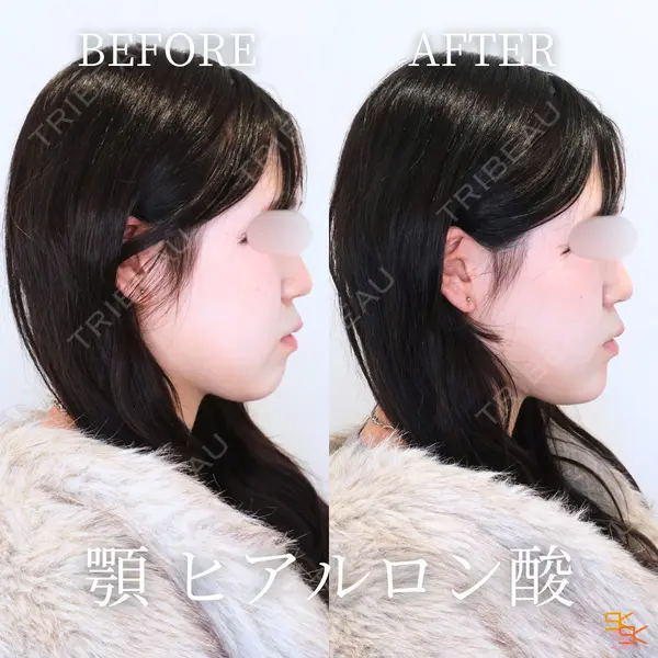 SK新宿歌舞伎町美容外科・歯科 岩本昌樹医師の症例