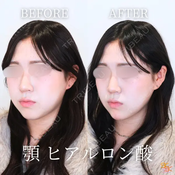 SK新宿歌舞伎町美容外科・歯科 岩本昌樹医師の症例