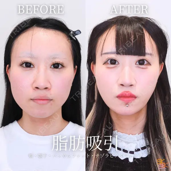 SK新宿歌舞伎町美容外科・歯科 岩本昌樹医師の症例