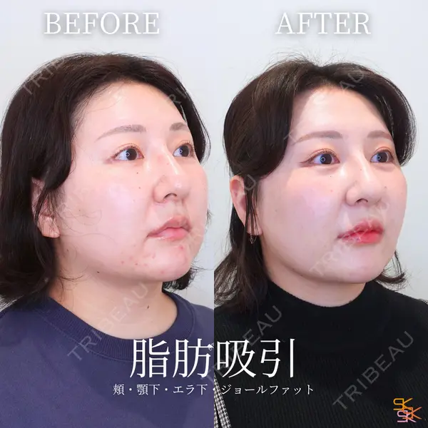 SK新宿歌舞伎町美容外科・歯科 岩本昌樹医師の症例