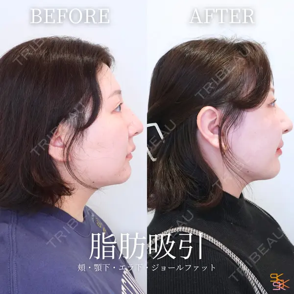 SK新宿歌舞伎町美容外科・歯科 岩本昌樹医師の症例