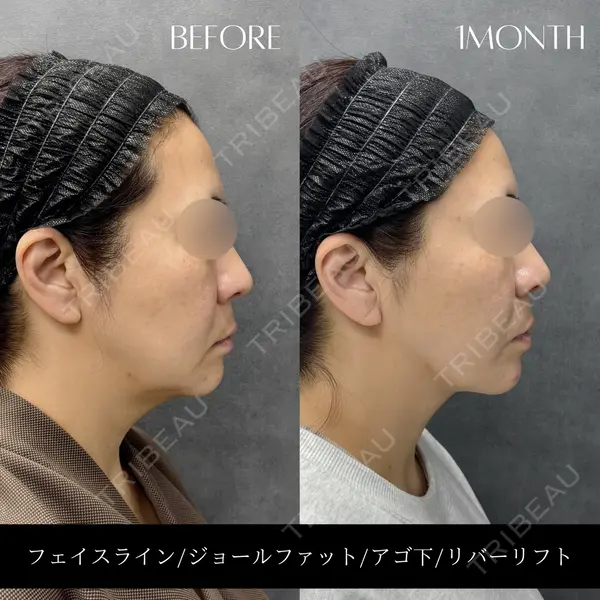 RIVER CLINIC（リバークリニック）大阪院の症例