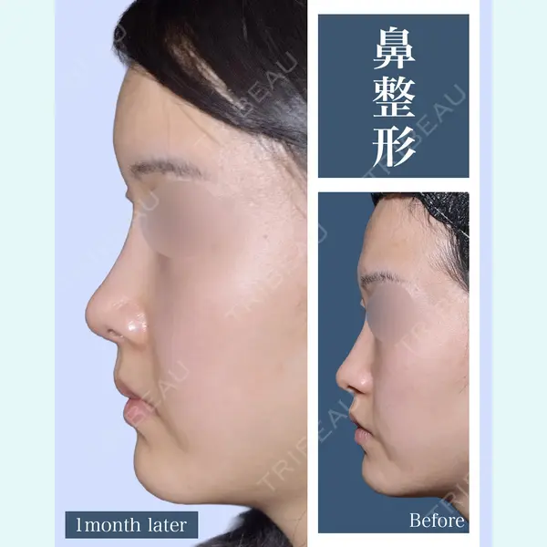 eクリニック 横浜みなとみらい院 坂本 優衣医師の症例