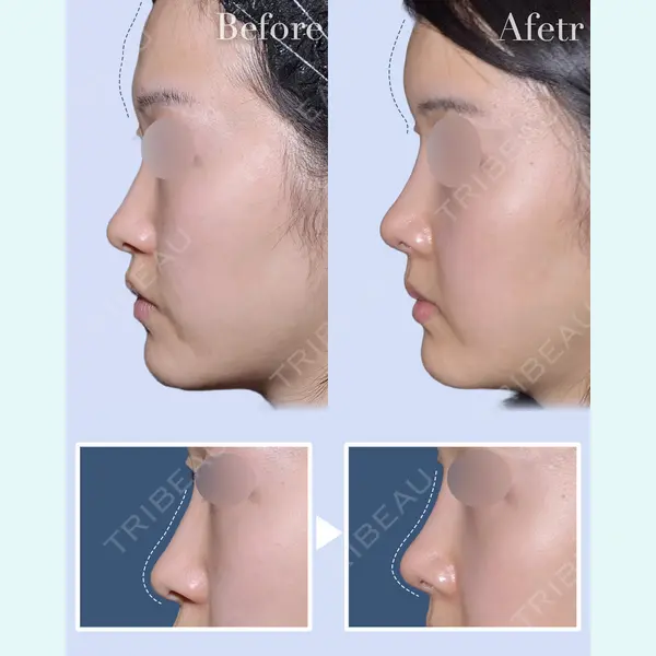 eクリニック 横浜みなとみらい院 坂本 優衣医師の症例