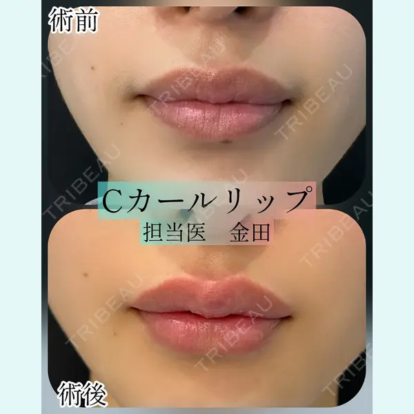 ルラ美容クリニック 横浜院 金田 成美医師の症例