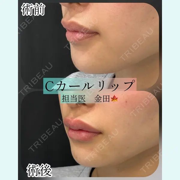 ルラ美容クリニック 横浜院 金田 成美医師の症例