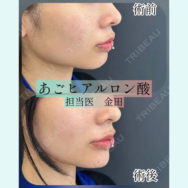 ルラ美容クリニック 横浜院 金田 成美医師の症例