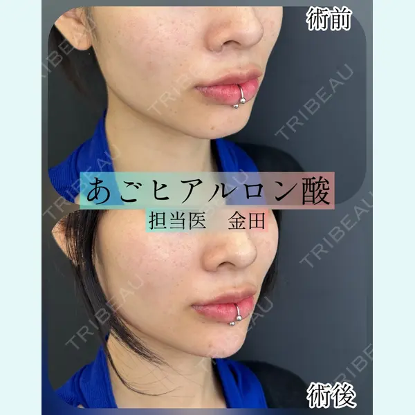 ルラ美容クリニック 横浜院 金田 成美医師の症例