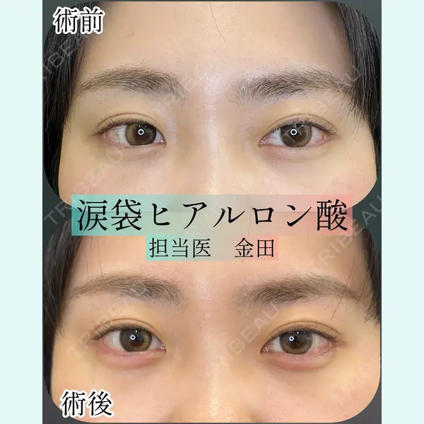 ルラ美容クリニック 横浜院 金田 成美医師の症例