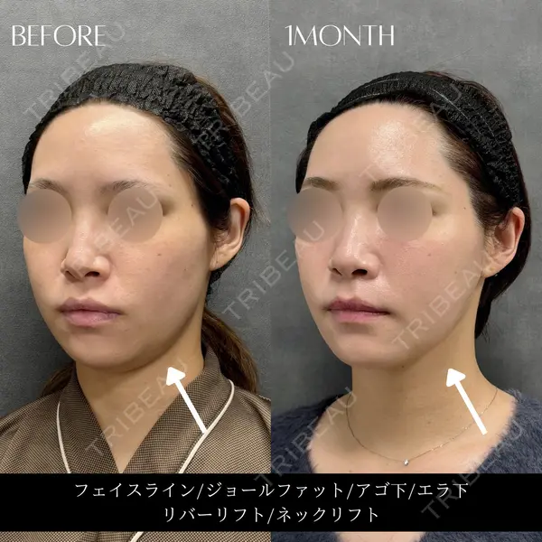 RIVER CLINIC（リバークリニック）大阪院の症例