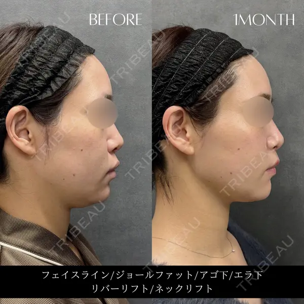 RIVER CLINIC（リバークリニック）大阪院の症例