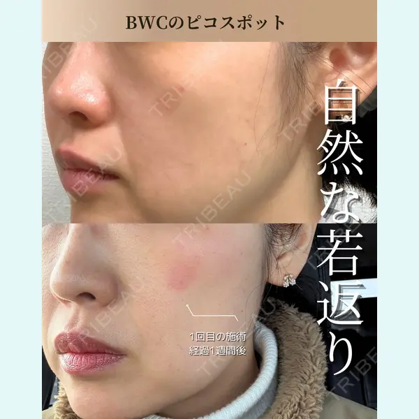 ビューティー和心クリニック 浅草院の症例