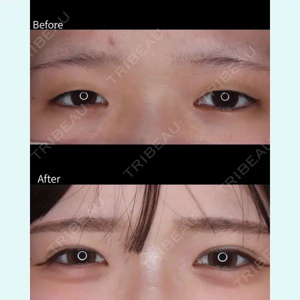 吉祥寺アイビークリニック 佐藤 淳俊医師の症例