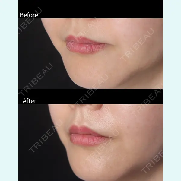 吉祥寺アイビークリニック 佐藤 淳俊医師の症例