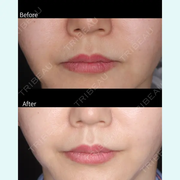 吉祥寺アイビークリニック 佐藤 淳俊医師の症例